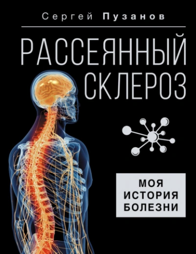 Рассеянный склероз. Моя история болезни - Сергей Пузанов - Библиотека аудиокниг